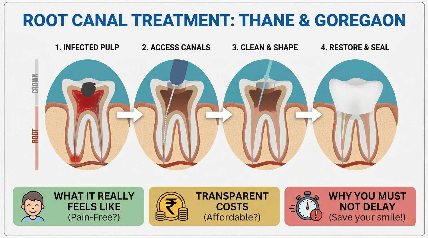Root Canal Treatment Experience